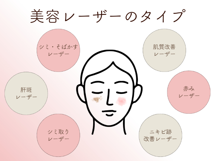 美容レーザーのタイプ