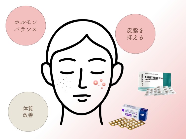 自費内服治療（難治性・大人ニキビ）