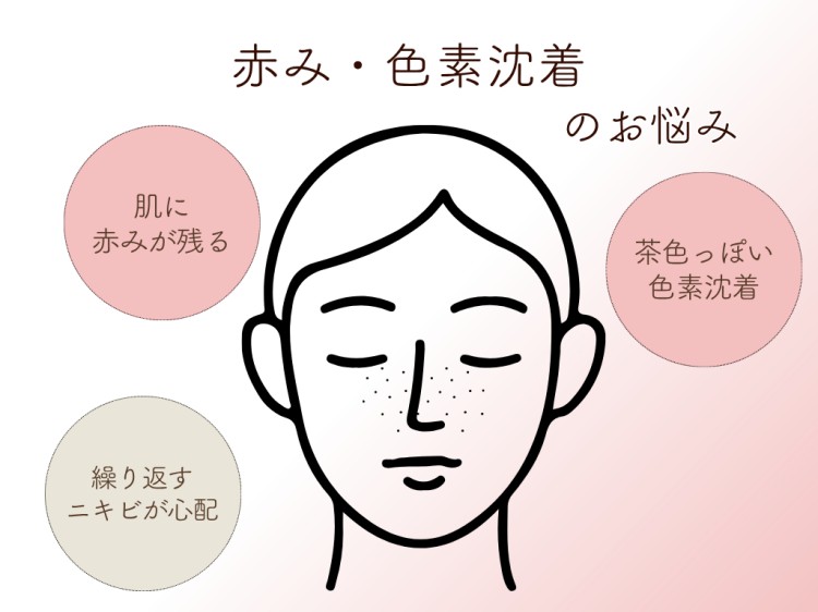 赤み・色素沈着のお悩み