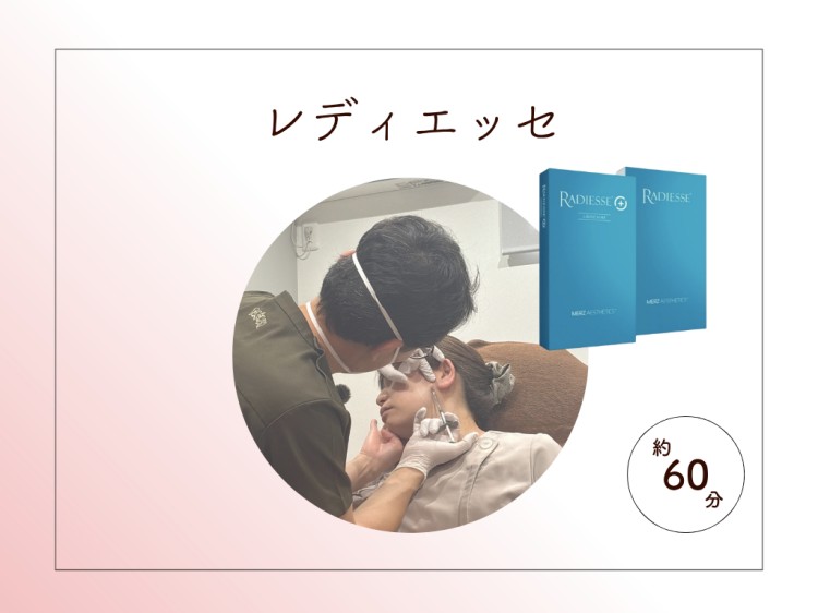 レディエッセ