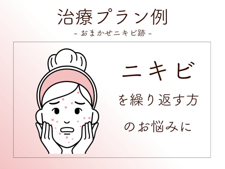 治療プラン例 おまかせニキビ跡