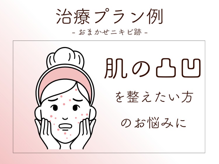 治療プラン例 おまかせニキビ跡