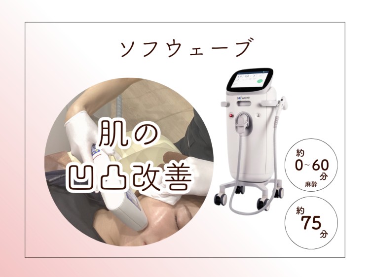ソフウェーブ