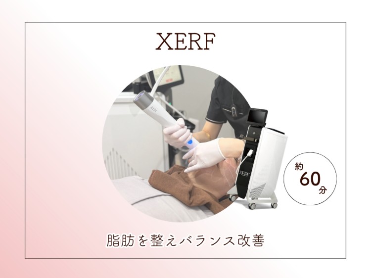 XERF