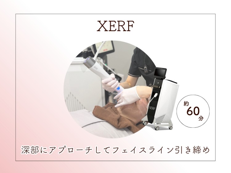 XERF