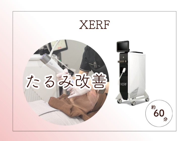 XERF