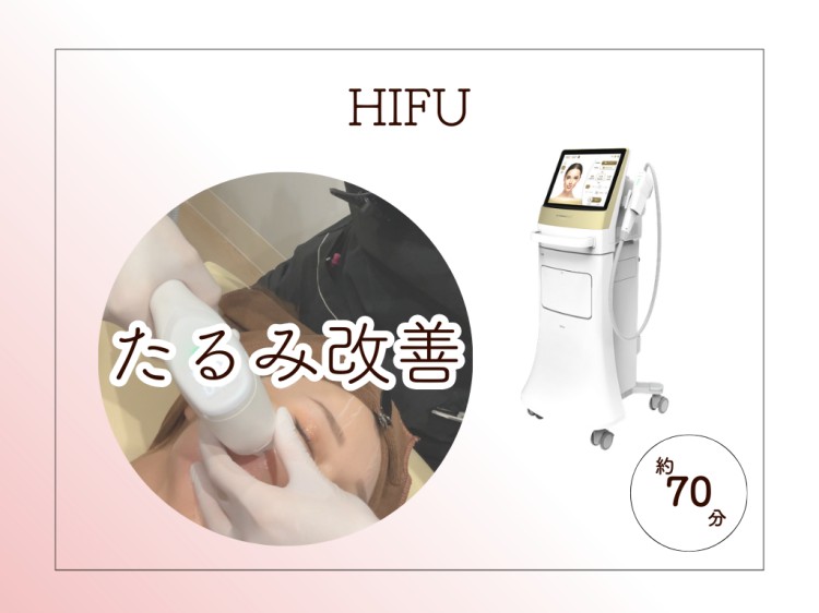 HIFU