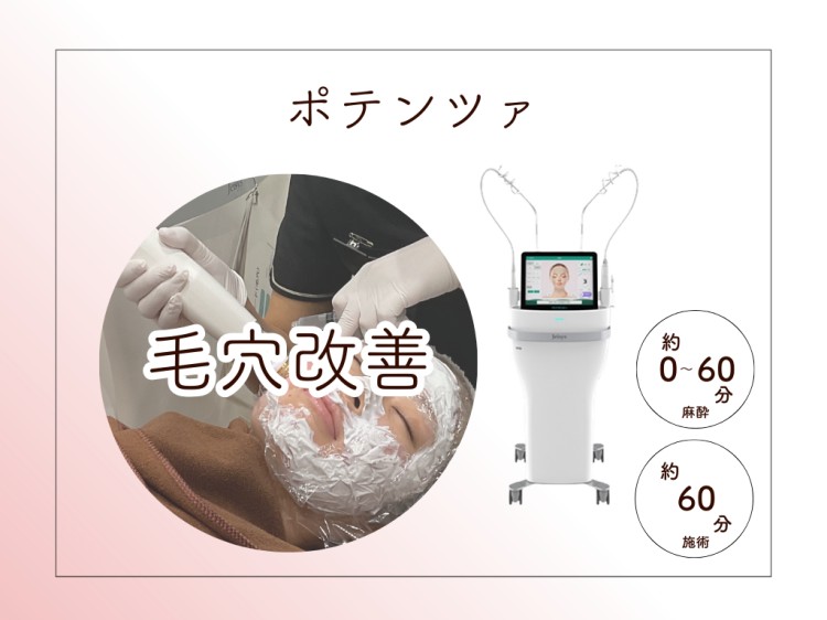 ポテンツァ