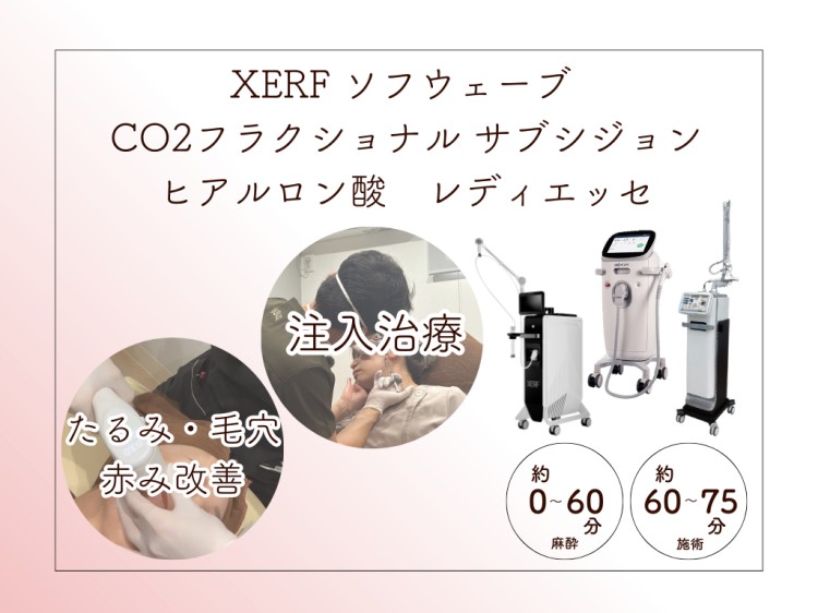XERFソフウェーブ