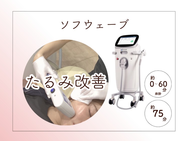 ソフウェーブ