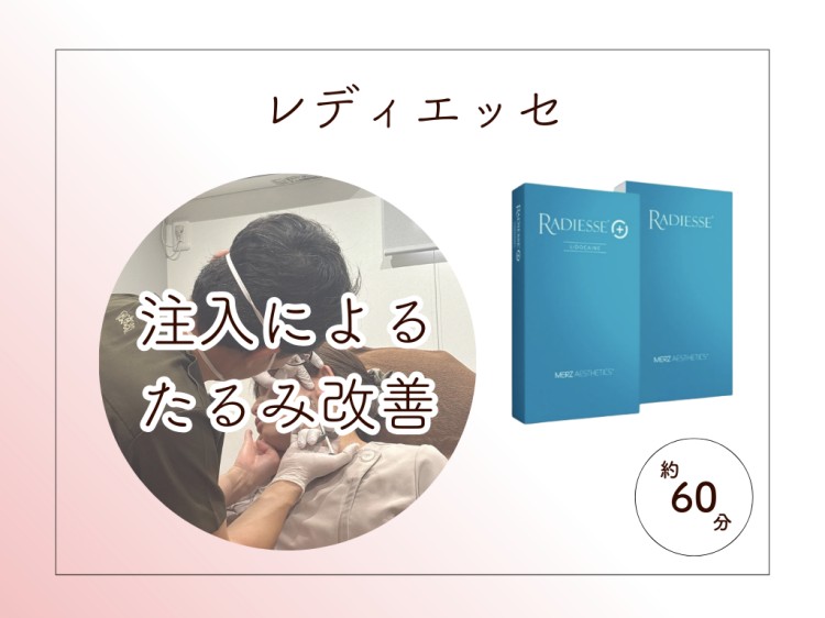 レディエッセ