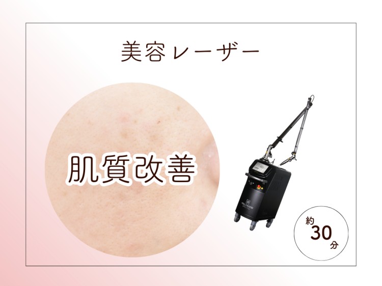 美容レーザー