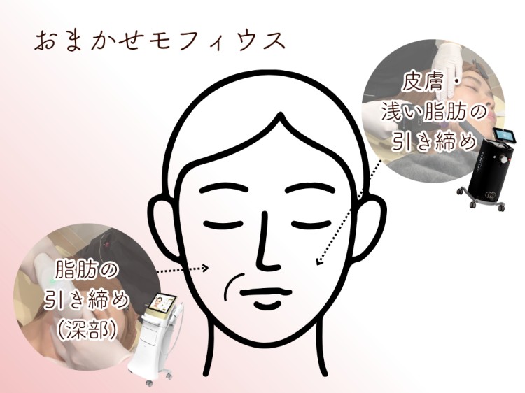 おまかせモフィウス