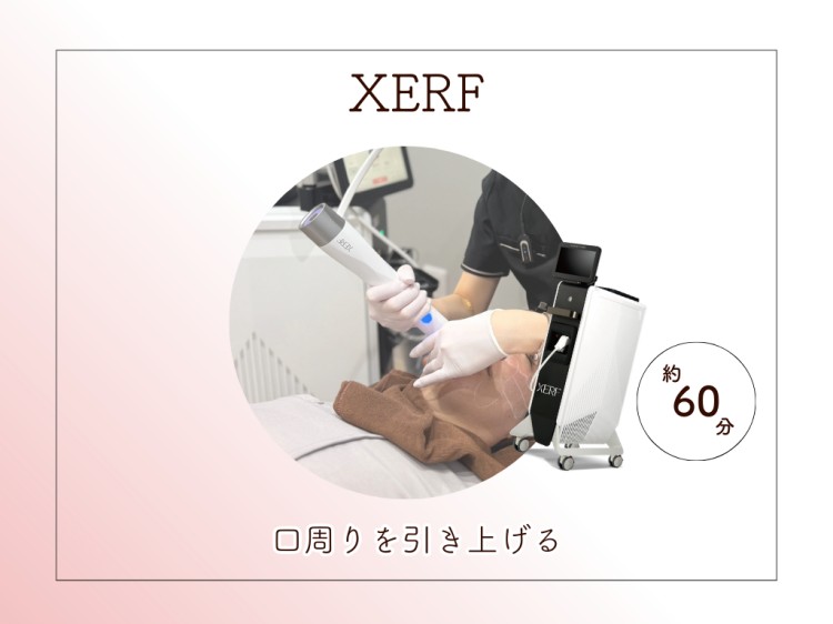 XERF