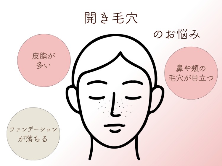 開き毛穴のお悩み