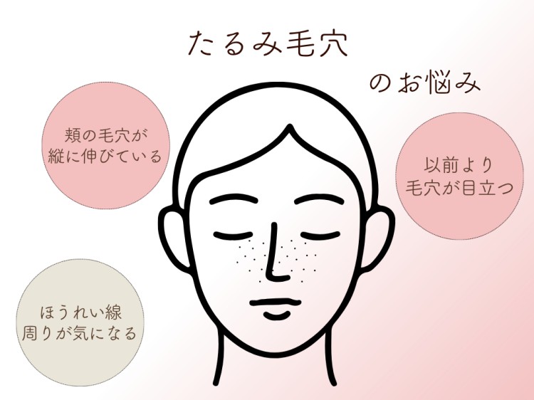 たるみ毛穴のお悩み