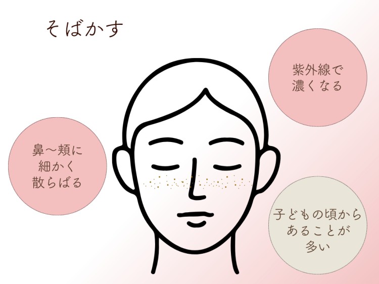 そばかす
