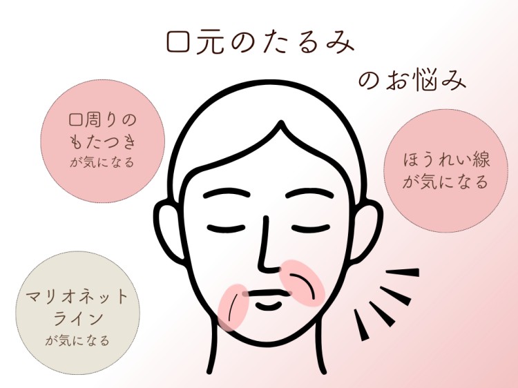 口元のたるみのお悩み
