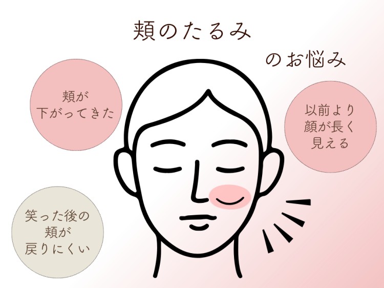 頬のたるみのお悩み