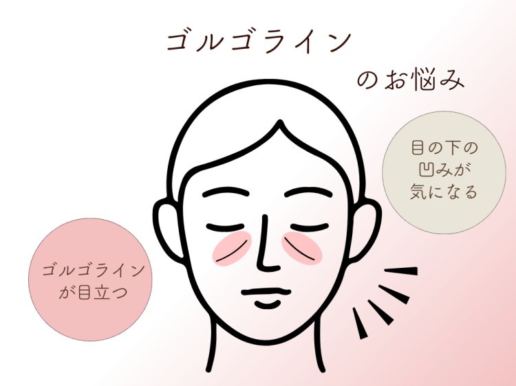 ゴルゴラインのお悩み