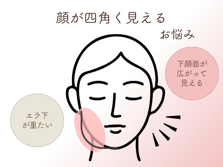 顔が四角く見えるお悩み