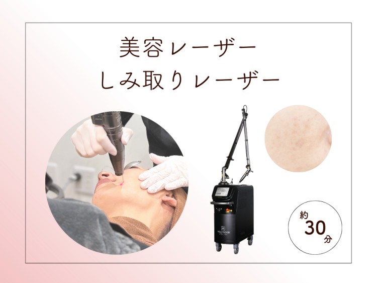 美容レーザー、シミ取りレーザー