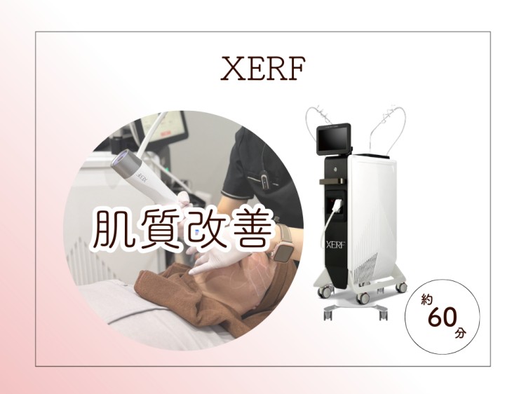 XERF