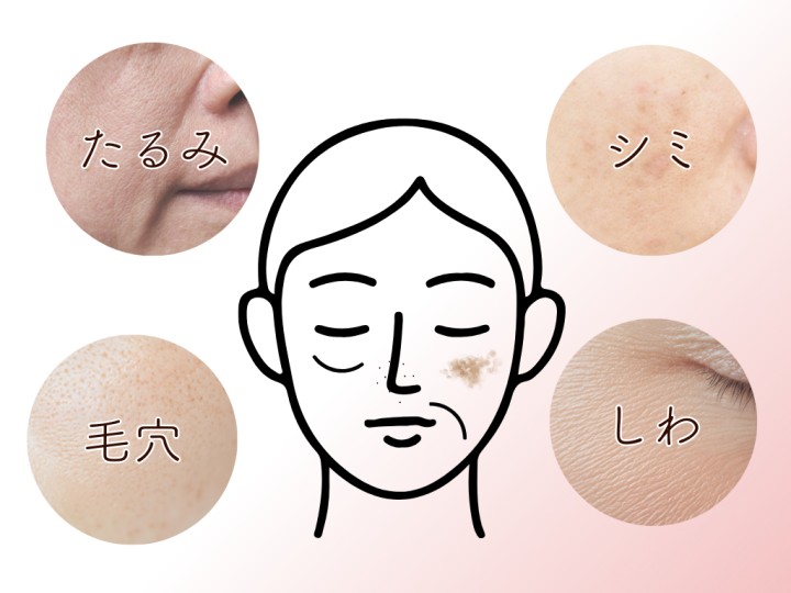 たるみ、しみ、毛穴、しわ