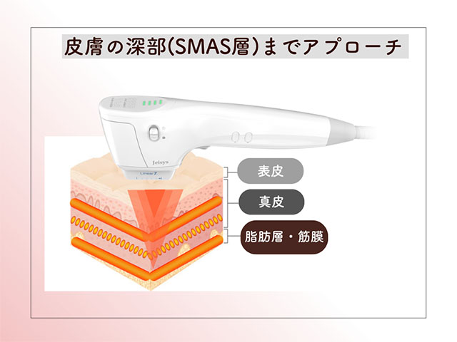 皮膚の深部（SMAS層）までアプローチ
