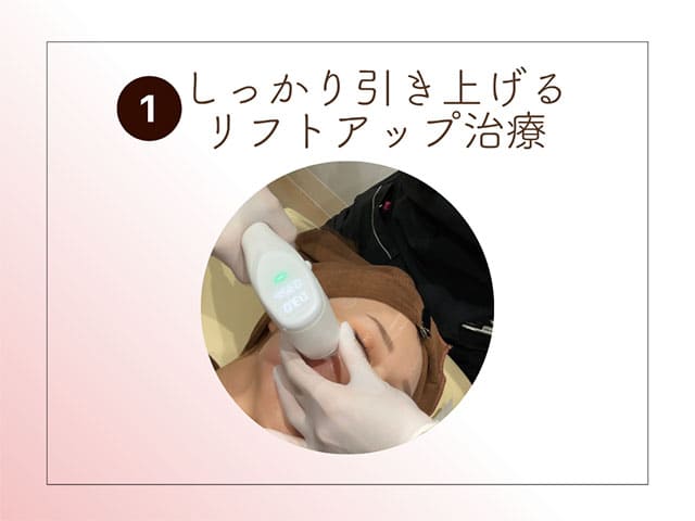 しっかり引き上げるリフトアップ治療