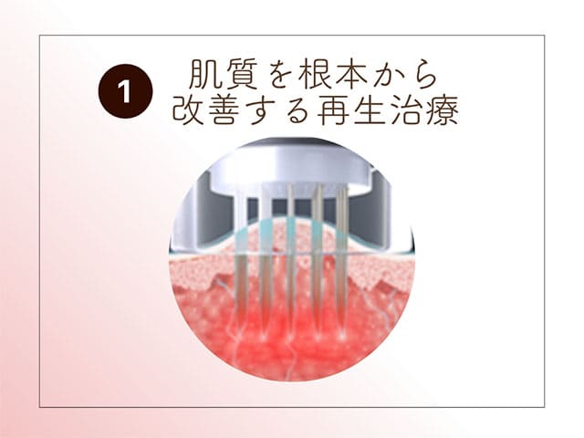 肌質を根本から改善する再生治療