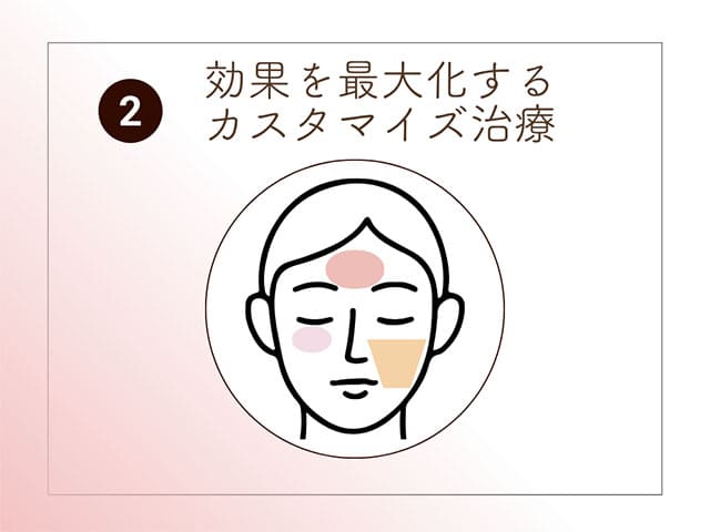 効果を最大化するカスタマイズ治療