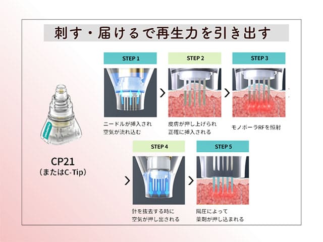 刺す・届けるで再生力を引き出す
