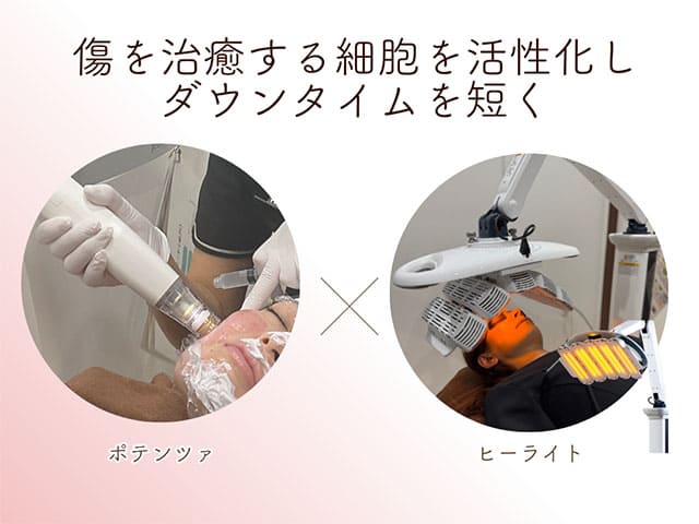 傷を治癒する細胞を活性化しダウンタイムを短く