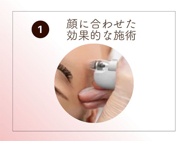 顔に合わせた効果的な施術