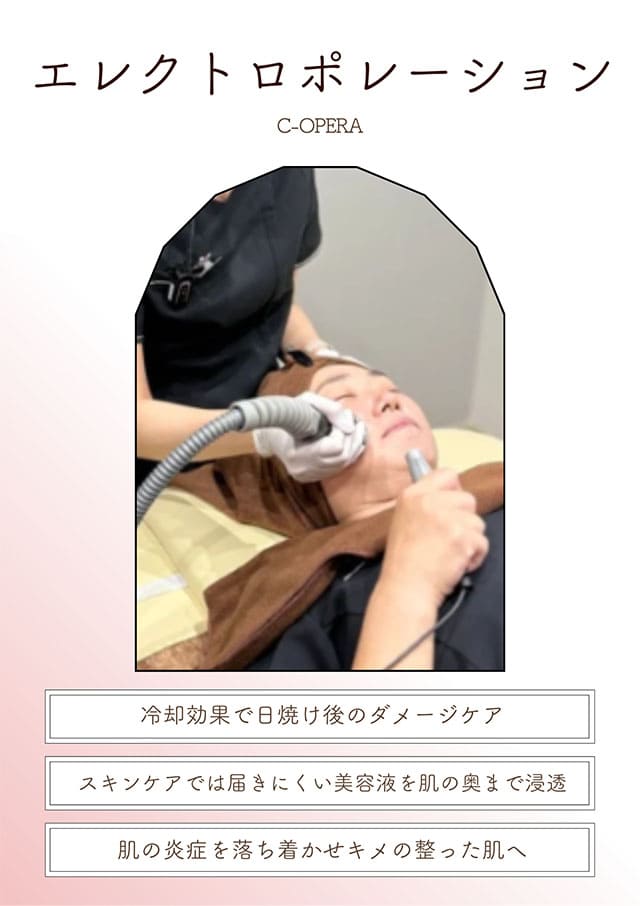 エレクトロポレーション(C-OPERA)