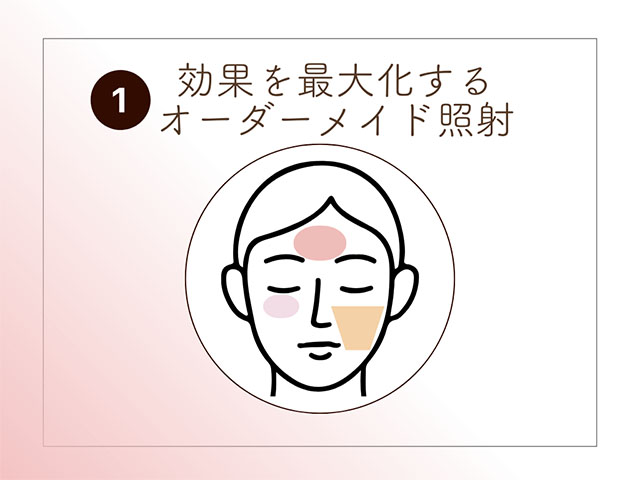 効果を最大化するオーダーメイド照射