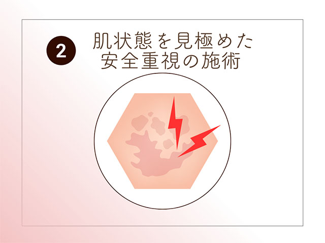 肌状況を見極めた安全重視の施術