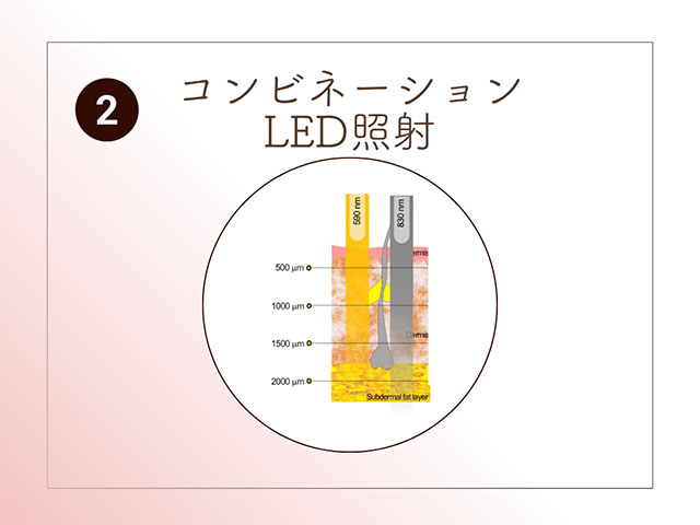 コンビネーションLED照射