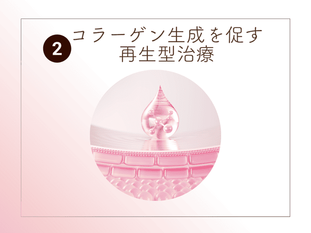 コラーゲン生成を促す再生型治療