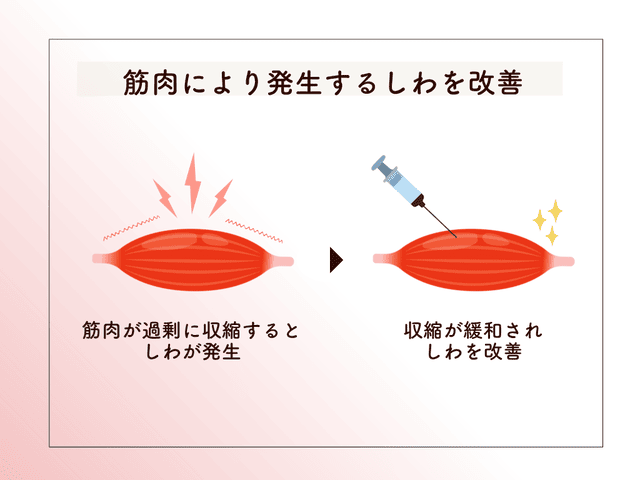 筋肉により発生するしわを改善