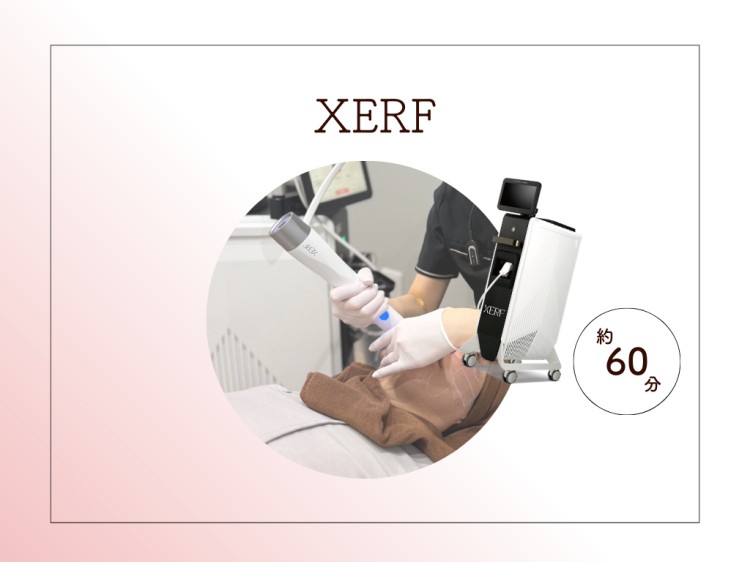 XERF