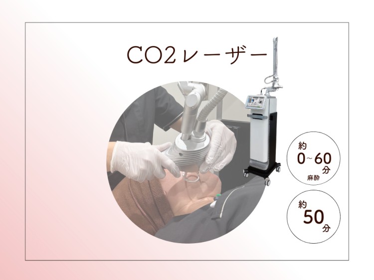 CO2レーザー