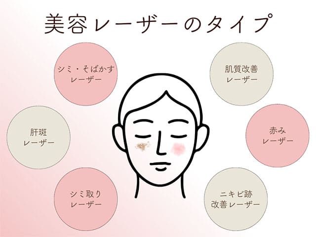 美容レーザーのタイプ