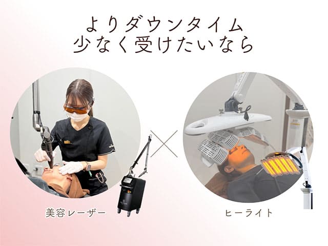 よりダウンタイム少なく受けたいなら